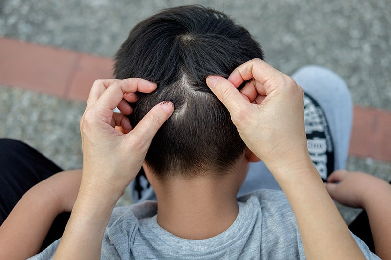 Home Remedies for Lice: 11 Ways to Treat Lice Naturally